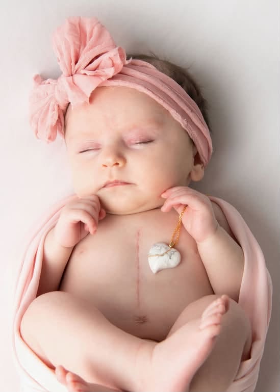 Four-year-old Aria Cenatiempo was born with Tetralogy of Fallot. Here's how you can help her family find a rare medical answer and support her care.